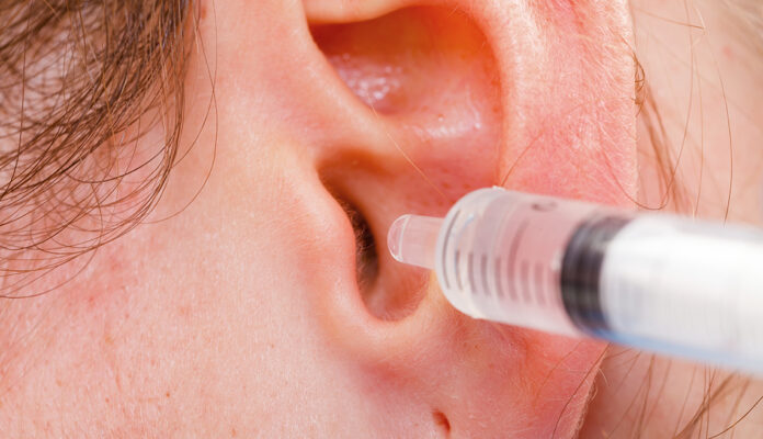How to Safely Syringe Ears at Home